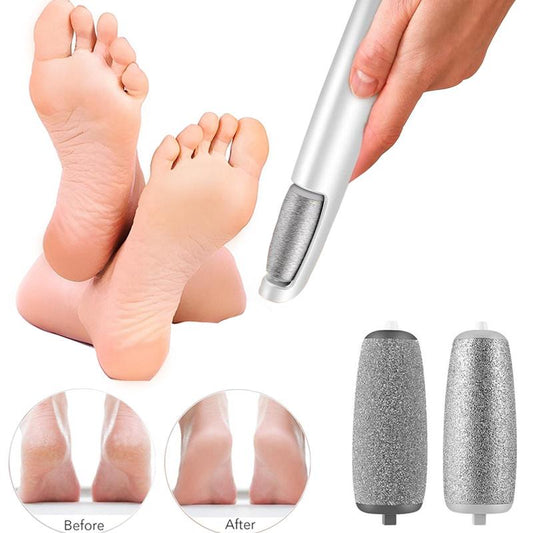 Electric Callus Remover – Smooth Feet Instantly